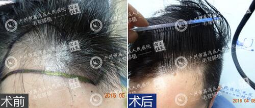 奥美定
