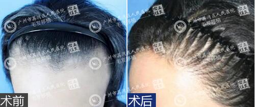 奥美定
